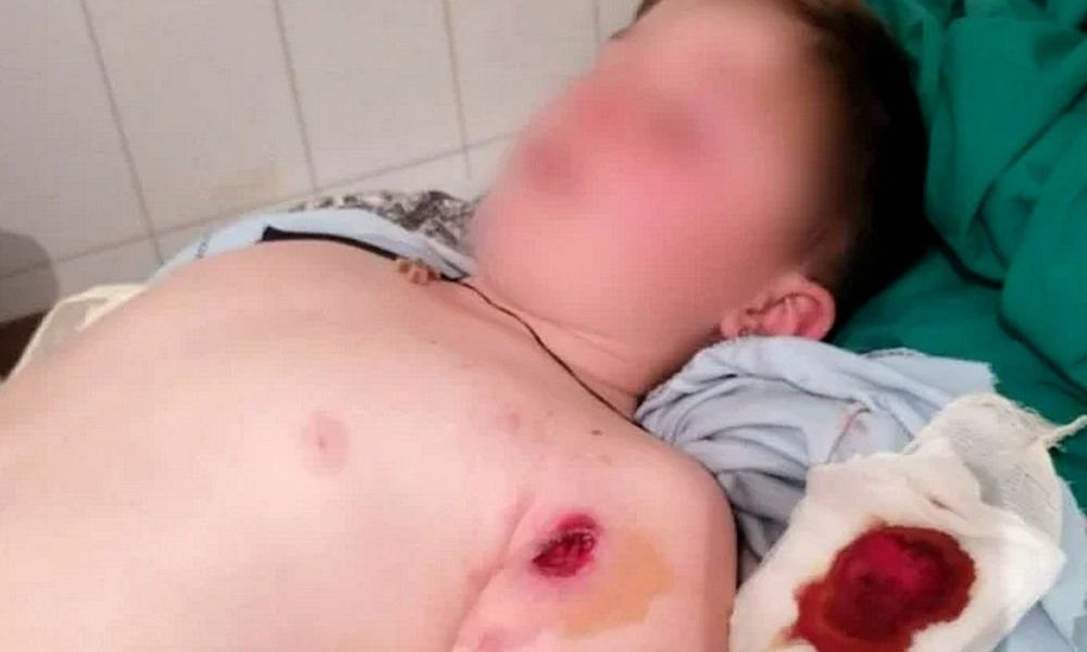 Véres ünnep: a sebesült szerb fiatalember