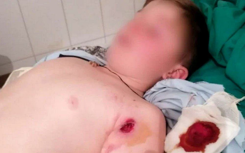 Véres ünnep: a sebesült szerb fiatalember